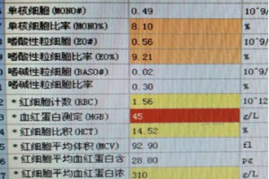 不可忽视的寄生虫感染