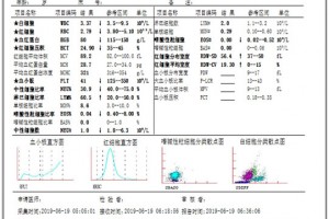 治疗相关骨髓增生异常综合征（t-MDS）的诊断分析