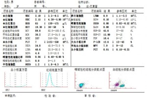 1例小细胞肺癌骨髓转移的综合诊断