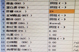 血糖低值危急值，尿糖2+，这到底怎么回事？