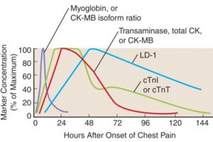 CK-MB三个结果，该信谁？