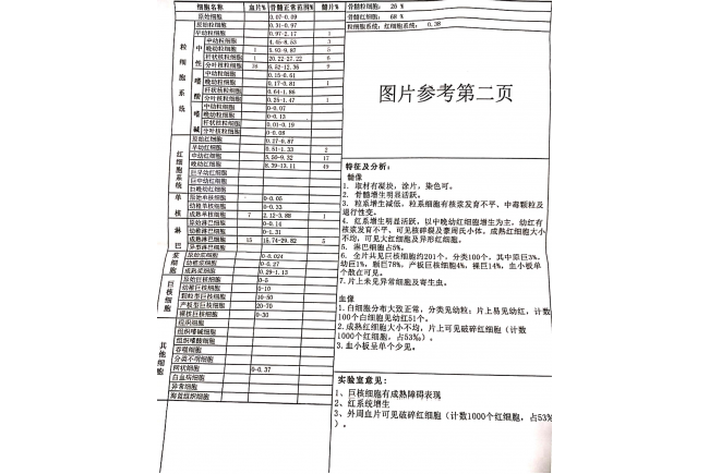 一例血小板减少的诊断