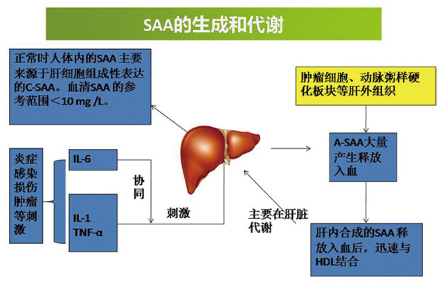 血清淀粉样蛋白A（SAA）  —急性时相反应的“急先锋”