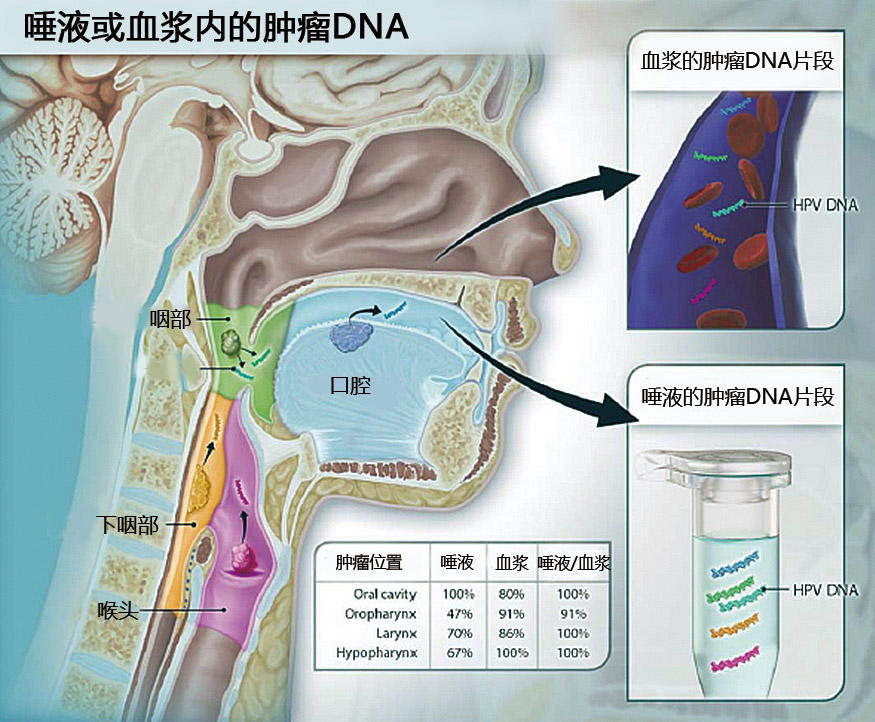 头颈部鳞状细胞癌患者血浆和唾液内 HPV和体细胞突变的检测