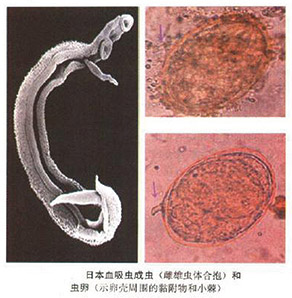 常见人体消化道寄生虫 形态特点