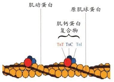 高灵敏度肌钙蛋白 检测性别特异的临界点的使用