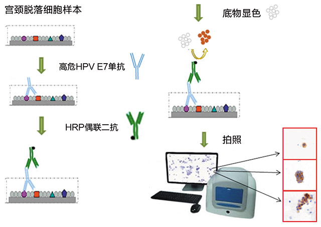 E7蛋白检测技术 在宫颈癌早期筛查中的应用