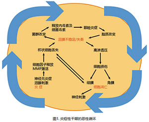 欧洲严重干眼诊断共识