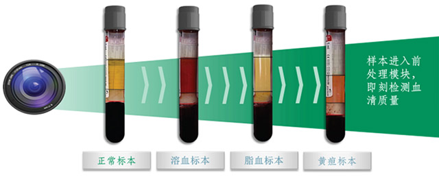 匠心十年，智享未来 —— 罗氏自动化解决方案给您带来升级体验