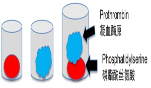 抗磷脂酰丝氨酸凝血酶原复合物抗体 （aPS/PT）的临床应用