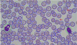 临床实验室智能化机器学习方法在血细胞自动识别和计数中的应用