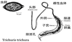 鞭虫感染与检验鉴定一例分析