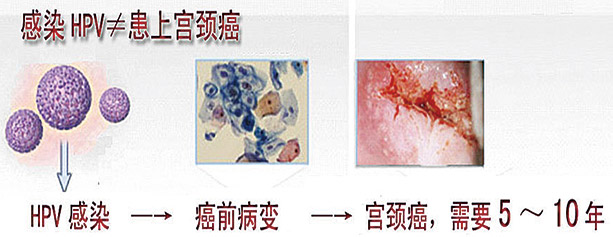 Clinical-Lab_Review_HPV与宫颈癌_V05B-6.jpg