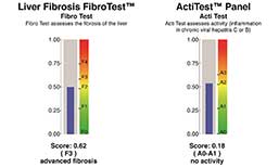 HCV-Resistance-Tests-and-Fibrotests.jpg