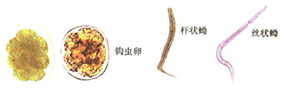 人体常见消化道寄生虫及检验-2.jpg