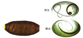 人体常见消化道寄生虫及检验-3.jpg