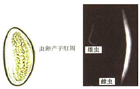 人体常见消化道寄生虫及检验-4.jpg