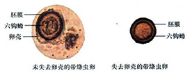 人体常见消化道寄生虫及检验-7.jpg