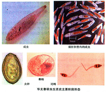 人体常见消化道寄生虫及检验-8.jpg
