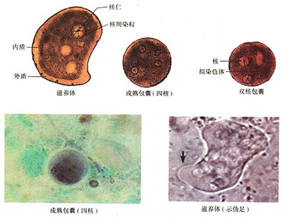 人体常见消化道寄生虫及检验-10.jpg