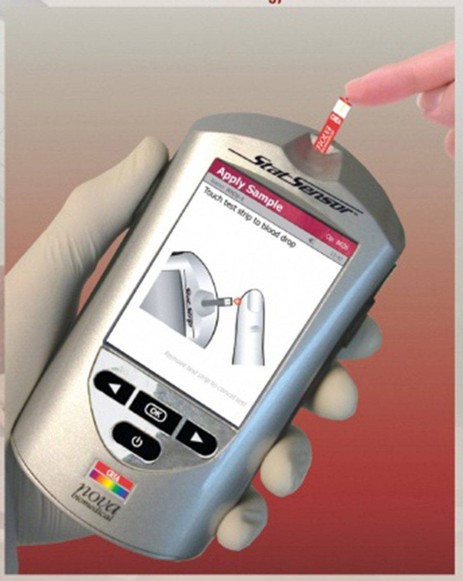 StatSensor-Creatinine-POC-Monitoring-System.jpg