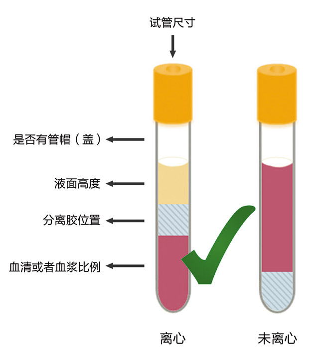 经验交流-罗氏-图3.jpg