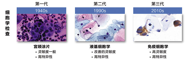 经验交流-艾托金-图1.jpg