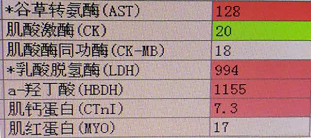 案例分析-糖化血红蛋白为0-5.jpg