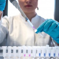 大规模新型冠状病毒核酸检测中临床实验室面临的挑战