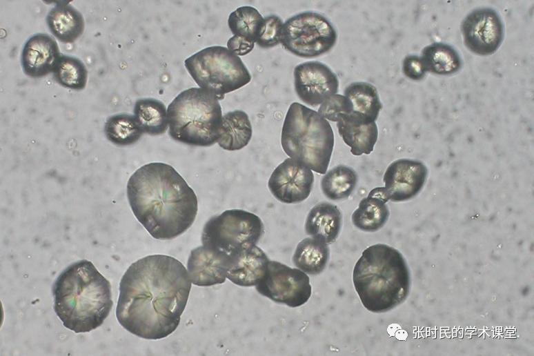 张时民老师带你认识各种尿结晶
