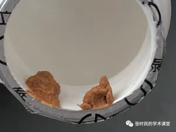 结晶尿肉眼图片