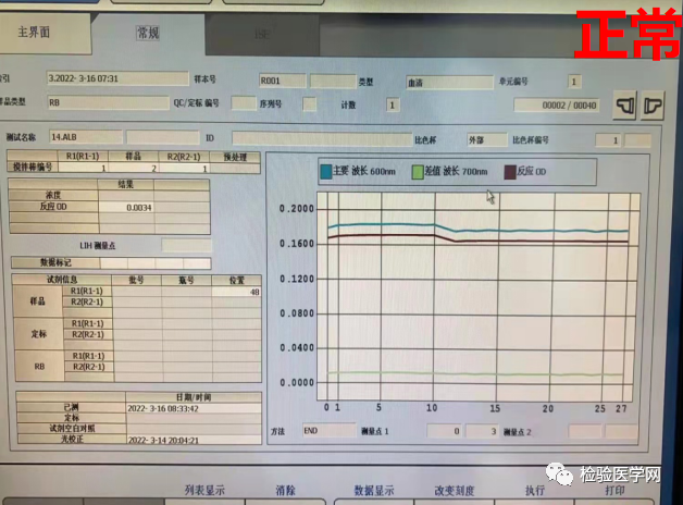 生化试剂水空白“上蹿下跳”，这个原因一般人还真想不到