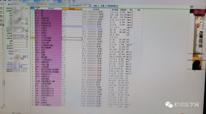 一看就懂 | 审核常规生化检验报告从这3个方面入手