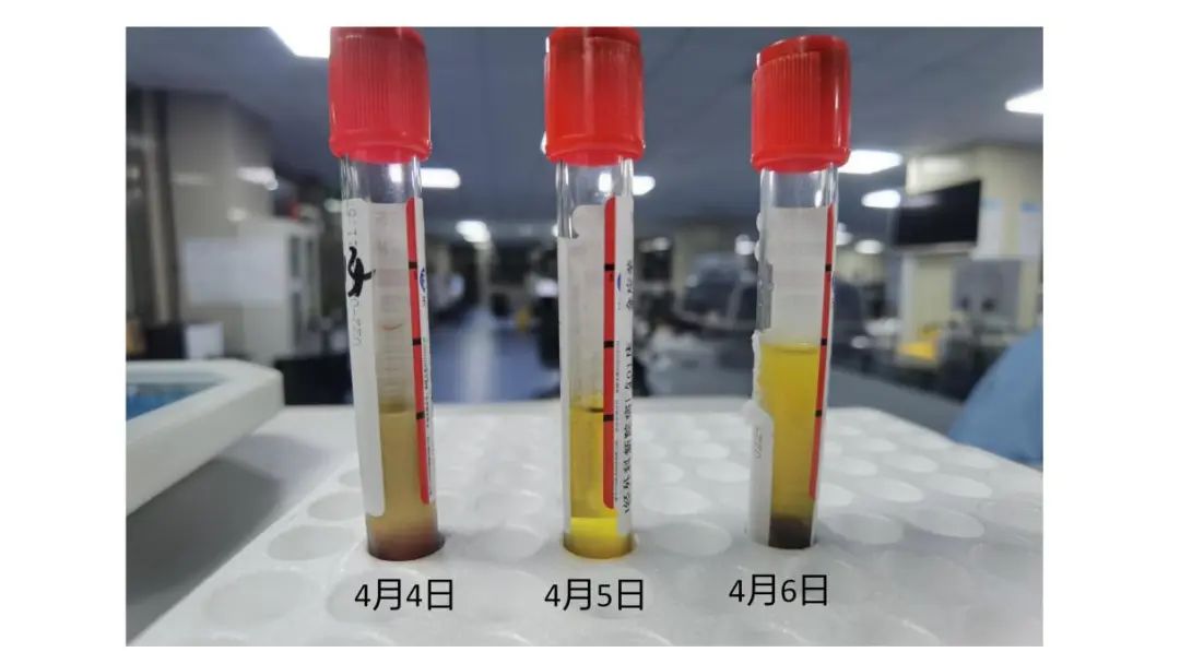 四起「实验室结果与临床不符」的案例