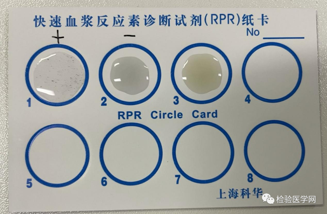 梅毒总闹乌龙，真假难辨！万万没想到，“真凶”就是它！