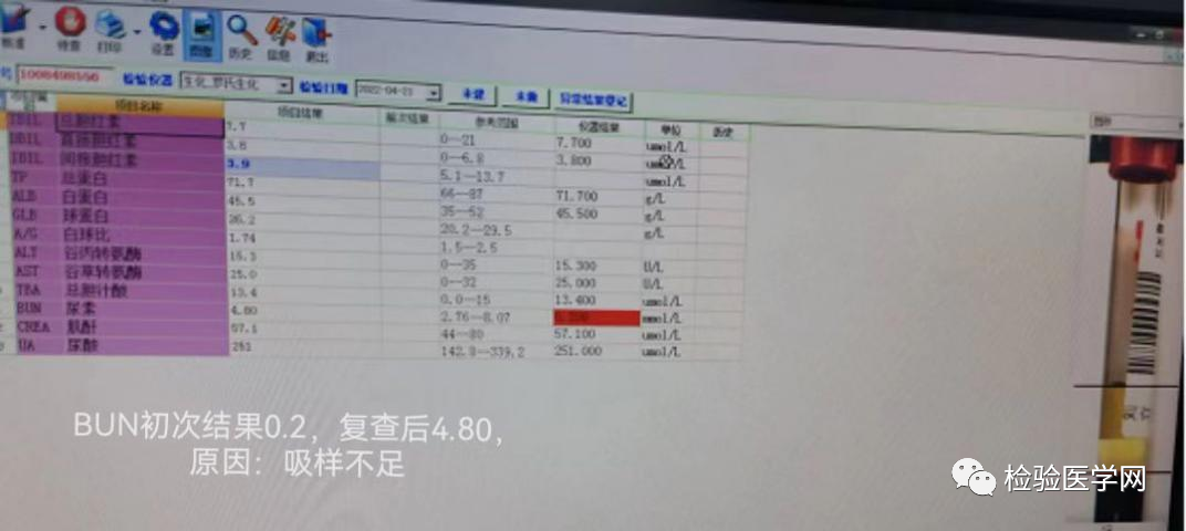 审核常规生化检验报告，不得不培养的N个惯性思维