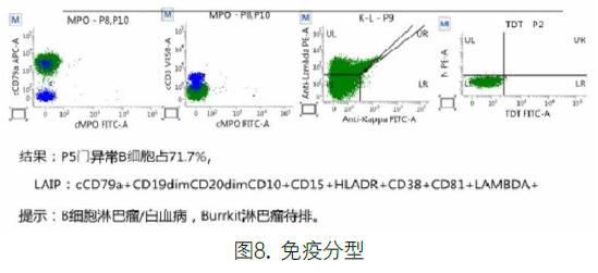 伯基特淋巴瘤/白血病1例分析及文献复习