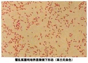 检出一例O139霍乱弧菌