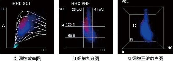 血细胞形态学参数在疾病诊断与鉴别诊断中的临床应用价值