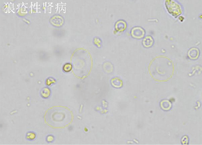 《尿液检验有形成分名称与结果报告专家共识》中有关尿红细胞形态的解析