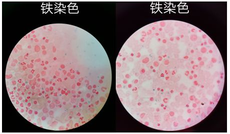 铁染色结果图片图片