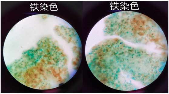 铁染色结果图片图片