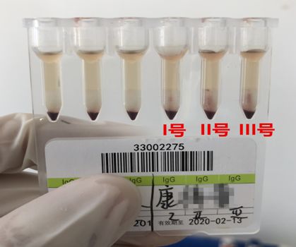 血型诡事，谁在捣乱？