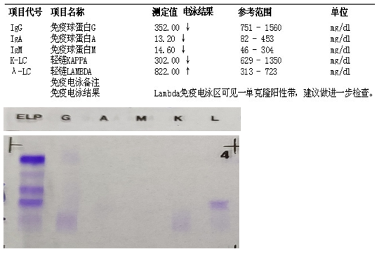 免疫固定血清検査とは何ですか?