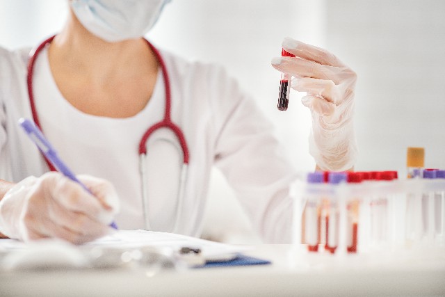 性激素六项在多囊卵巢综合征辅助诊断中的应用