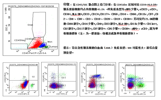 髓/淋混合白血病，还是AML跨系表达 CD2/CD5/CD7？