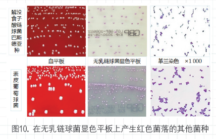 自动化临床微生物检测系统与质谱鉴定结果的差异及鉴别