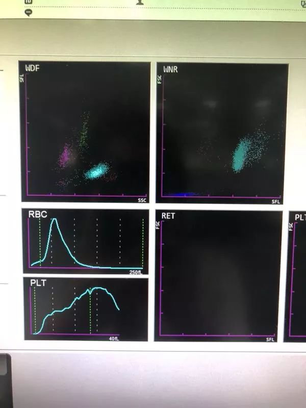 血常规散点图的启示_疾病相关_检验视界_检验视界网