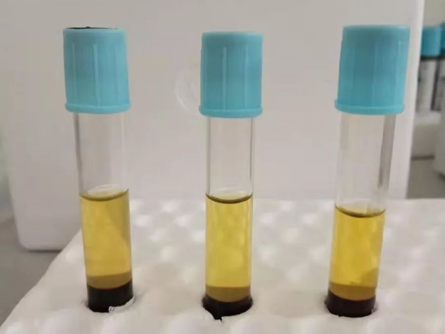 如下图一所示,三份标本并未出现溶血,黄疸,脂血的现象.