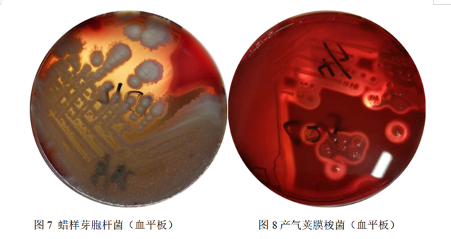 血培养中检出蜡样芽胞杆菌一定是污染的吗?_学术交流_检验视界_检验视界网
